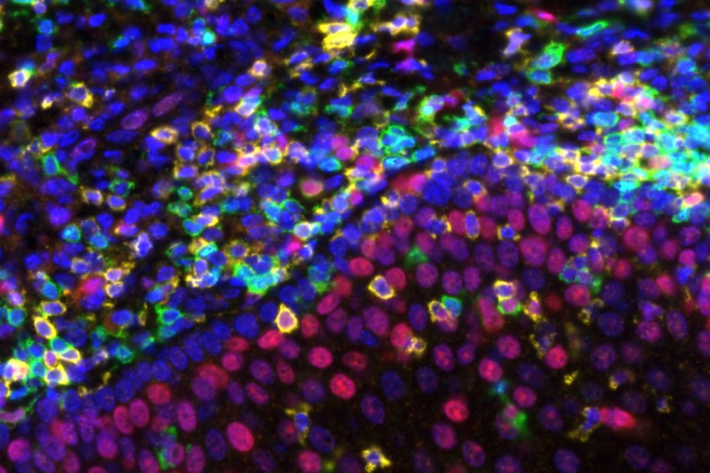 Rockefeller's CD40 Antibody Redesign Clears 20-Year Hurdle in Cancer Trial