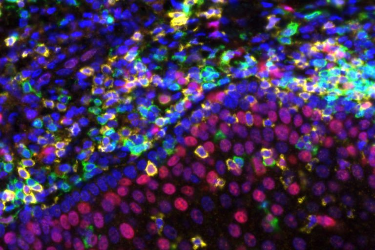 Rockefeller’s CD40 Antibody Redesign Clears 20-Year Hurdle in Cancer Trial